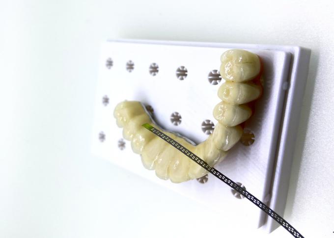 Polishing Dental Diamond Finishing Strips Interdental Abrasives Untuk Ortodontik 1